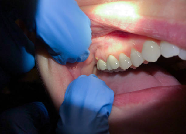 Best Root Canal Emergency Dentist  in Ruleville, MS