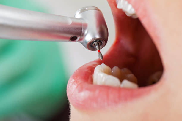 Best Knocked-Out Tooth Emergency  in Ruleville, MS